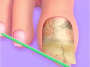 Doctor of your Foot - ASMR Nail Salon Game Relaxation Game